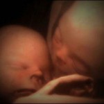 ikiz bebeklerin hamileliği – ikiz bebeklerin ay ay gelişimi